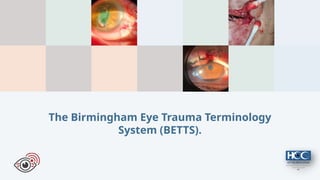 Betts Classification Abordaje Inicial Del Trauma oftalmologico | PPTX