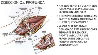 DISECCION Qx. PROFUNDA
• HAY QUE TENER EN CUENTA QUE
RARAS VECES ES PRECISA UNA
EXPOSICION COMPLETA
• DEBEN PRESERVARSE TODAS LAS
PARTES BLANDAS ADHERIDAS AL
HUESO QUE SEA POSIBLE
• YA QUE SI SE DESPEGAN
DEMASIADO ESTAS INSERCIONES
TISULARES SE REDUCE EL
APORTE VASCULAR A LOS
FRAGMENTOS OSEOS Y SE
PONDRA EN PELIGRO LA
CONSOLIDACION
 