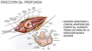 DISECCION Qx. PROFUNDA
• SIEMPRE MANTENER n.
CUBITAL APARTADO DEL
CAMPO Qx. DURANTE
TODAS LAS FASES DE LA
DISECCION NUNCA
OLVIDAR
 