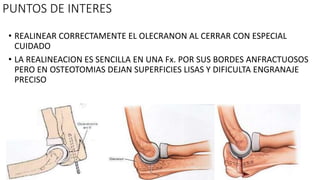 PUNTOS DE INTERES
• REALINEAR CORRECTAMENTE EL OLECRANON AL CERRAR CON ESPECIAL
CUIDADO
• LA REALINEACION ES SENCILLA EN UNA Fx. POR SUS BORDES ANFRACTUOSOS
PERO EN OSTEOTOMIAS DEJAN SUPERFICIES LISAS Y DIFICULTA ENGRANAJE
PRECISO
 