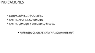 • EXTRACCION CUERPOS LIBRES
• RAFI Fx. APOFISIS CORONOIDE
• RAFI Fx. CONDILO Y EPICONDILO MEDIAL
INDICACIONES
• RAFI (REDUCCION ABIERTA Y FIJACION INTERNA)
 