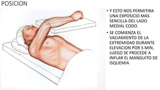 • Y ESTO NOS PERMITIRA
UNA EXPOSICIO MAS
SENCILLA DEL LADO
MEDIAL CODO.
• SE COMIENZA EL
VACIAMIENTO DE LA
EXTREMIDAD DURANTE
ELEVACION POR 5 MIN,
LUEGO SE PROCEDE A
INFLAR EL MANGUITO DE
ISQUEMIA
POSICION
 