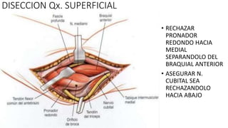 • RECHAZAR
PRONADOR
REDONDO HACIA
MEDIAL
SEPARANDOLO DEL
BRAQUIAL ANTERIOR
• ASEGURAR N.
CUBITAL SEA
RECHAZANDOLO
HACIA ABAJO
DISECCION Qx. SUPERFICIAL
 