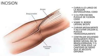 INCISION
• CURVA A LO LARGO DE
LA REGION
ANTEROLATERAL CODO
• 5 Cm POR ENCIMA
PLIEGUE DE FLEXION
CODO
• SOBRE EL BORDE
LATERAL BICEPS
• CURVAR MEDIALMENTE
Y ASI EVITAR CRUZAR EL
PLIEGUE
TRANSVERSALMENTE
• CONTINUAR SIGUIENDO
DISTALMENTE POR EL
BORDE MEDIAL DEL M.
BRAQUIORRADIAL Y EL
LIMITE SERA SOLO LA
CANTIDAD DE RADIO
QUE SE NECESITE
EXPONER
 