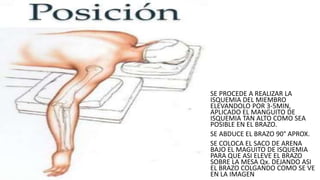 • SE PROCEDE A REALIZAR LA
ISQUEMIA DEL MIEMBRO
ELEVANDOLO POR 3-5MIN,
APLICADO EL MANGUITO DE
ISQUEMIA TAN ALTO COMO SEA
POSIBLE EN EL BRAZO.
• SE ABDUCE EL BRAZO 90° APROX.
• SE COLOCA EL SACO DE ARENA
BAJO EL MAGUITO DE ISQUEMIA
PARA QUE ASI ELEVE EL BRAZO
SOBRE LA MESA Qx. DEJANDO ASI
EL BRAZO COLGANDO COMO SE VE
EN LA IMAGEN
 