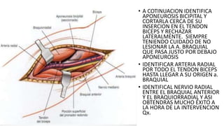• A COTINUACION IDENTIFICA
APONEUROSIS BICIPITAL Y
CORTARLA CERCA DE SU
INSERCION EN EL TENDON
BICEPS Y RECHAZAR
LATERALMENTE. SIEMPRE
TENIENDO CUIDADO DE NO
LESIONAR LA A. BRAQUIAL
QUE PASA JUSTO POR DEBAJO
APONEUROSIS
• IDENTIFICAR ARTERIA RADIAL
POR TODO EL TENDON BICEPS
HASTA LLEGAR A SU ORIGEN a.
BRAQUIAL
• IDENTIFICAL NERVIO RADIAL
ENTRE EL BRAQUIAL ANTERIOR
Y EL BRAQUIORRADIAL Y ASI
OBTENDRAS MUCHO ÉXITO A
LA HORA DE LA INTERVENCION
Qx.
 