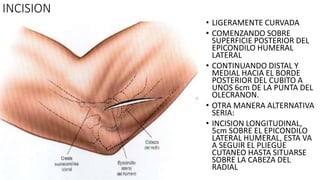 INCISION
• LIGERAMENTE CURVADA
• COMENZANDO SOBRE
SUPERFICIE POSTERIOR DEL
EPICONDILO HUMERAL
LATERAL
• CONTINUANDO DISTAL Y
MEDIAL HACIA EL BORDE
POSTERIOR DEL CUBITO A
UNOS 6cm DE LA PUNTA DEL
OLECRANON.
• OTRA MANERA ALTERNATIVA
SERIA:
• INCISION LONGITUDINAL,
5cm SOBRE EL EPICONDILO
LATERAL HUMERAL, ESTA VA
A SEGUIR EL PLIEGUE
CUTANEO HASTA SITUARSE
SOBRE LA CABEZA DEL
RADIAL
 