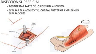 • DESINSERTAR PARTE DEL ORIGEN DEL ANCONEO
• SEPARAR EL ANCONEO Y EL CUBITAL POSTERIOR EMPLEANDO
SEPARADORES
DISECCION SUPERFICIAL
 
