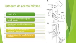Abordaje Quir rgico De La Enfermedad De Hirschsprung pptx Abordaje Quir rgico De La Enfermedad De Hirschsprung pptx