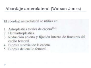 Abordaje anterolateral (Watson Jones)
 
