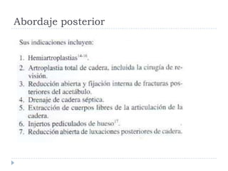 Abordaje posterior
 