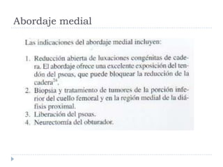 Abordaje medial
 