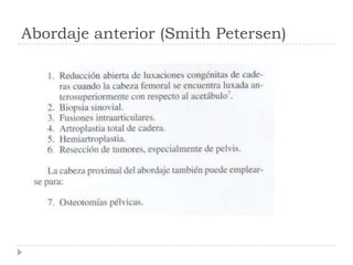 Abordaje anterior (Smith Petersen)
 