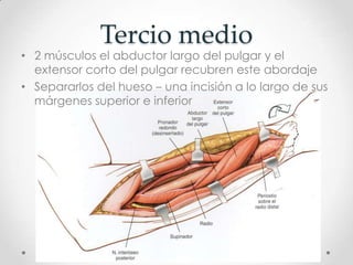 Tercio medio
• 2 músculos el abductor largo del pulgar y el
  extensor corto del pulgar recubren este abordaje
• Separarlos del hueso – una incisión a lo largo de sus
  márgenes superior e inferior
 