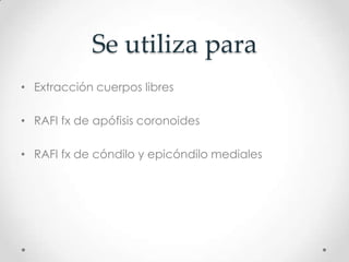 Se utiliza para
• Extracción cuerpos libres

• RAFI fx de apófisis coronoides

• RAFI fx de cóndilo y epicóndilo mediales
 