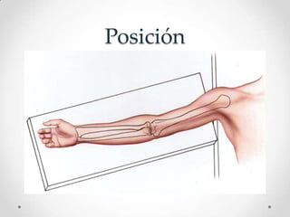 Posición
 