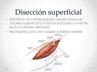 Disección superficial
• Identificar el n antebraquial cutáneo lateral al
  hacerse superficial a la fascia profunda a nivel de
  los 5 cm distales del brazo
• Rechazarlo junto con colgajo cutáneo medial
 