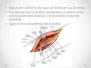 • Seguir al n radial hasta que se divida en sus 3 ramas
• Por debajo de la división desarrollar un plano entre
  el braquiorradial (lateral) y el pronador redondo
  (medial)
• Ligar ramas recurrentes de a radial
 