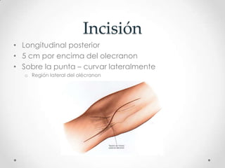 Incisión
• Longitudinal posterior
• 5 cm por encima del olecranon
• Sobre la punta – curvar lateralmente
   o Región lateral del olécranon
 