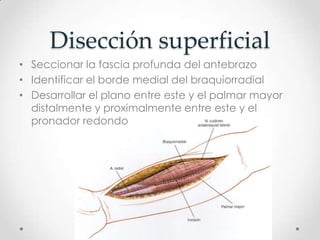 Disección superficial
• Seccionar la fascia profunda del antebrazo
• Identificar el borde medial del braquiorradial
• Desarrollar el plano entre este y el palmar mayor
  distalmente y proximalmente entre este y el
  pronador redondo
 