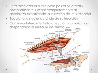 • Para desplazar el n interóseo posterior lateral y
  posteriormente supinar completamente al
  antebrazo exponiendo la inserción del m supinador
• Seccionarlo siguiendo el eje de su inserción
• Continuar lateralmente la disección subperióstica
  despegando el músculo del hueso
 