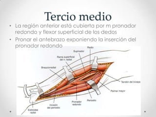 Tercio medio
• La región anterior está cubierta por m pronador
  redondo y flexor superficial de los dedos
• Pronar el antebrazo exponiendo la inserción del
  pronador redondo
 