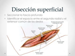 Disección superficial
• Seccionar la fascia profunda
• Identificar el espacio entre el segundo radial y el
  extensor común de los dedos
 