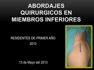 ABORDAJES
QUIRURGICOS EN
MIEMBROS INFERIORES
RESIDENTES DE PRIMER AÑO
2013
13 de Mayo del 2013
 