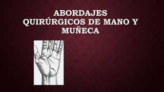 ABORDAJES
QUIRÚRGICOS DE MANO Y
MUÑECA
 