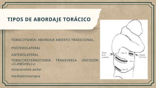 Abordaje toracico _20241018_180311_0000.pptx