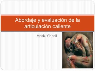 Mock, Yinnell
Abordaje y evaluación de la
articulación caliente
 