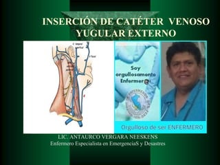 INSERCIÓN DE CATÉTER VENOSO
YUGULAR EXTERNO
LIC. ANTAURCO VERGARA NEESKENS
Enfermero Especialista en EmergenciaS y Desastres
 