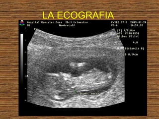LA ECOGRAFIA
 
