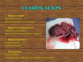 CLASIFICACION
• Según el origen:
Aborto provocado
Aborto espontaneo o involuntario

•  Según las consecuencias:
Aborto no complicado
Aborto complicado (infectado o séptico)

•  Según su termino :
aborto completo
aborto incompleto

•  Otras formas:
aborto habitual
aborto fustrado o retencion de embrión o feto muerto
 