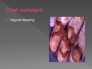  Vaginal bleeding
 