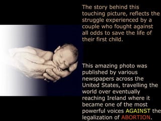 The story behind this
touching picture, reflects the
struggle experienced by a
couple who fought against
all odds to save the life of
their first child.
This amazing photo was
published by various
newspapers across the
United States, travelling the
world over eventually
reaching Ireland where it
became one of the most
powerful voices AGAINST the
legalization of ABORTION.
 