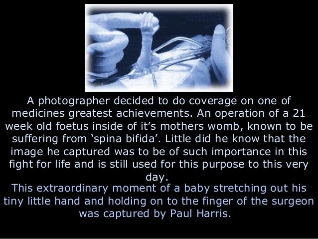 A Letter From An Unborn Baby To His Mom