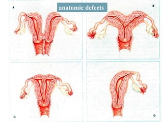 anatomic defects
 