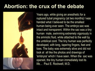 Abortion: the crux of the debate 
Years ago, while giving an anesthetic for a 
ruptured tubal pregnancy (at two months) I was 
handed what I believed to be the smallest 
human being ever seen. The embryo sac was 
intact and transparent. Within the sac was a tiny 
human male, swimming extremely vigorously in 
the amniotic fluid, while attached to the wall by 
the umbilical cord. The tiny human was perfectly 
developed, with long, tapering fingers, feet and 
toes. The baby was extremely alive and did not 
look at all like the photos and drawings of 
'embryos' which I have seen. When the sac was 
opened, the tiny human immediately lost its 
life… Paul E. Rockwell, M.D. 
 