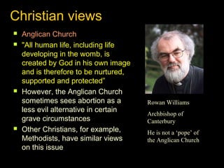 Christian views 
 Anglican Church 
 "All human life, including life 
developing in the womb, is 
created by God in his own image 
and is therefore to be nurtured, 
supported and protected” 
 However, the Anglican Church 
sometimes sees abortion as a 
less evil alternative in certain 
grave circumstances 
 Other Christians, for example, 
Methodists, have similar views 
on this issue 
Rowan Williams 
Archbishop of 
Canterbury 
He is not a ‘pope’ of 
the Anglican Church 
 