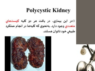 Polycystic Kidney
o‫در‬‫اين‬،‫ي‬‫بيمار‬‫در‬‫بافت‬‫هر‬‫دو‬‫كليه‬‫هاي‬‫كيست‬
‫متعددي‬‫وجود‬،‫د‬‫ر‬‫دا‬‫ي‬‫نحو‬‫به‬‫كه‬‫ها‬‫كليه‬‫در‬‫انجام‬‫عملك‬‫رد‬
‫طبيعي‬‫خود‬‫ناتوان‬‫هستند‬.
 