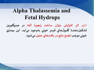 Alpha Thalassemia and
Fetal Hydrops
o‫در‬‫اثر‬‫افزايش‬‫میزان‬‫ساخت‬‫نجیرة‬‫ز‬‫آلفا‬‫در‬‫هموگلوبین‬
‫دهندة‬‫تشكيل‬‫هاي‬‫ل‬‫گلبو‬‫قرمز‬‫خوني‬‫وجود‬‫به‬‫آيد‬‫مي‬.‫اين‬‫بيما‬‫ي‬‫ر‬
‫خوني‬‫موجب‬‫تجمع‬‫مايع‬‫در‬‫هاي‬‫بافت‬‫جنین‬‫شود‬‫مي‬.
 