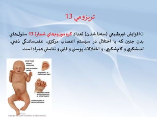 ‫مي‬‫و‬‫تريز‬13
o‫افزايش‬‫غیرطبيعي‬(‫تا‬‫سه‬‫شدن‬)‫تعداد‬‫هاي‬‫وم‬‫ز‬‫مو‬‫و‬‫كر‬‫ة‬‫ر‬‫شما‬13‫هاي‬‫ل‬‫سلو‬
‫بدن‬‫جنین‬‫كه‬‫با‬‫اختالل‬‫در‬‫سيستم‬‫اعصاب‬،‫ي‬‫مركز‬‫ماندگي‬‫عقب‬‫ذهني‬،
‫ي‬‫شكر‬‫لب‬‫و‬،‫ي‬‫شكر‬‫كام‬‫و‬‫اختالالت‬‫پوستي‬‫و‬‫قلبي‬‫و‬‫تناسلي‬‫اه‬‫ر‬‫هم‬‫اس‬‫ت‬.
 