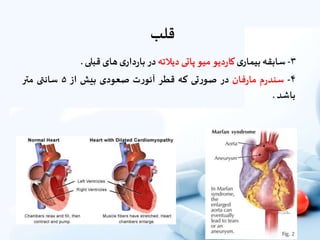 ‫قلب‬
۳-‫سابقه‬‫ى‬‫بیمار‬‫دیو‬‫ر‬‫کا‬‫میو‬‫پاتى‬‫دیالته‬‫در‬‫ى‬‫دار‬‫ر‬‫با‬‫هاى‬‫قبلى‬.
۴-‫م‬‫ر‬‫سند‬‫فان‬‫ر‬‫ما‬‫در‬‫تى‬‫ر‬‫صو‬‫که‬‫قطر‬‫ت‬‫ر‬‫آئو‬‫صعودى‬‫بیش‬‫از‬۵‫سانتی‬‫متر‬
‫باشد‬.
 