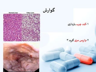 ‫ش‬‫ر‬‫گوا‬
۱-‫کبد‬‫چرب‬‫ى‬‫دار‬‫ر‬‫با‬
۲-‫یس‬‫ر‬‫وا‬‫ى‬‫مر‬‫گرید‬۳
 