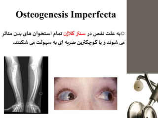 Osteogenesis Imperfecta
o‫به‬‫علت‬‫نقص‬‫در‬‫سنتز‬‫ن‬‫کالژ‬‫تمام‬‫استخوان‬‫های‬‫بدن‬‫م‬‫تاثر‬
‫می‬‫شوند‬‫و‬‫با‬‫کوچکترین‬‫ضربه‬‫ای‬‫به‬‫سهولت‬‫می‬‫شکن‬‫ند‬.
 