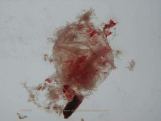 5/18/2018 29www.drjayeshpatidar.blogspot.com
 