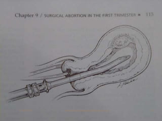 5/18/2018 34www.drjayeshpatidar.blogspot.com
 