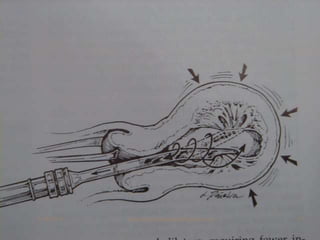 5/18/2018 35www.drjayeshpatidar.blogspot.com
 