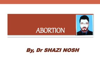 ABORTION
By, Dr SHAZI NOSH
 